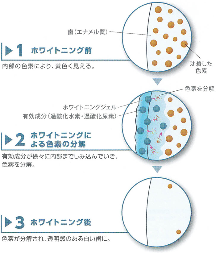 ホワイトニングのメカニズム